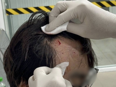 三名变性女子袭击中国游客，受害者头部受伤！