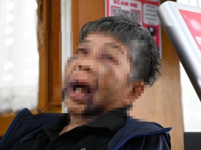 老人也不放过！78岁老妇被暴打抢劫，泰警方紧急追查