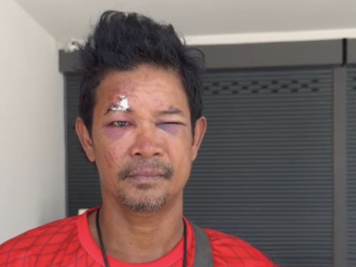 仅因 “疑似压到孩子”，男子当场被群殴，送医院再遭报复