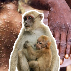 监狱新增2例痘病毒感染！封控升级