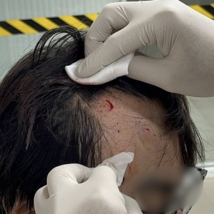 三名变性女子袭击中国游客，受害者头部受伤！