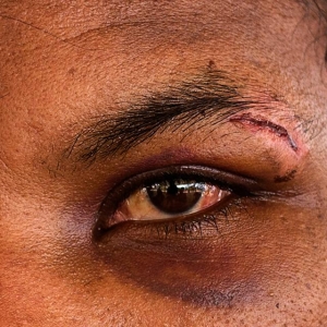 马国青年受困诈骗园区两年，曝光内幕遭主管报复