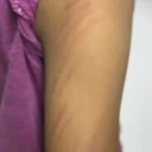 泰国小学教师因压力体罚学生？家长维权调查展开中