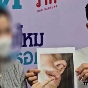 曼谷知名医院隆鼻手术失败！女网红投诉维权