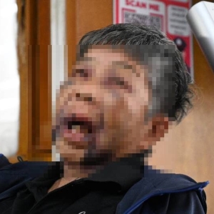 老人也不放过！78岁老妇被暴打抢劫，泰警方紧急追查