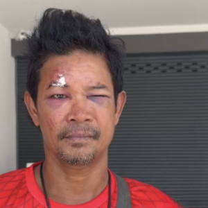 仅因 “疑似压到孩子”，男子当场被群殴，送医院再遭报复